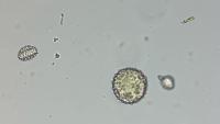 Pollen Detection project thumbnail