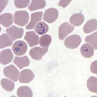 Find malaria cells and p.falcipalums project thumbnail