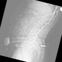 spinefrxnormalvindr-fsod-qget project thumbnail