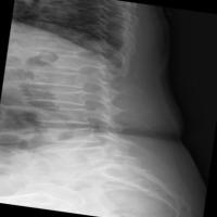 spinefrxnormalvindr-fsod-qget project thumbnail