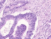 Colon Histology project thumbnail