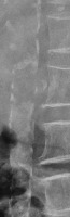 calclabel project thumbnail