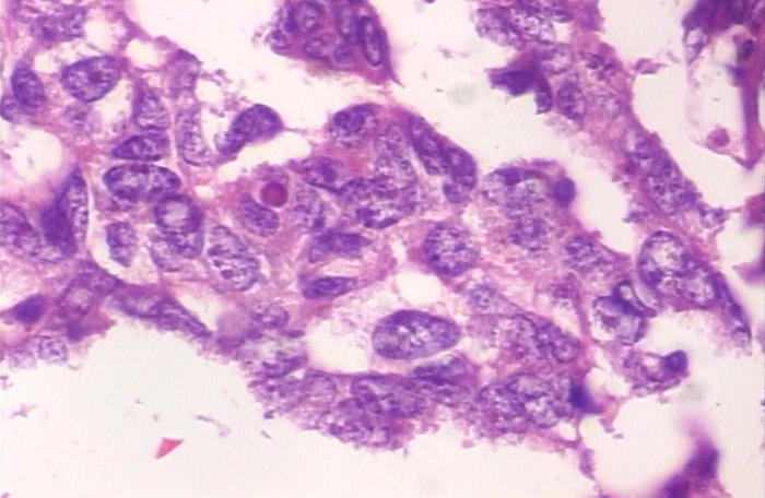 Malignant Classification Dataset by TRIAL