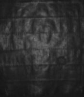 [2025.2]DriedGIM Foreign body_v1 project thumbnail