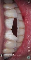 Traumatismos dentários (IADT) project thumbnail