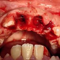 TRAUMATISMOS DENTÁRIOS project thumbnail