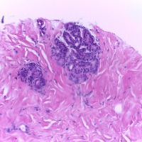 breastCancerImage project thumbnail