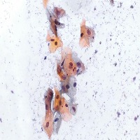 Cric Data Set project thumbnail