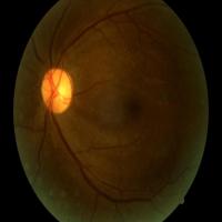 Eyes 4.1 project thumbnail