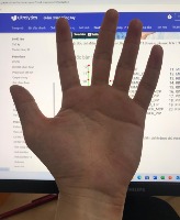 Hand Keypoint Detection project thumbnail