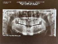 Dental_xray_annotator project thumbnail