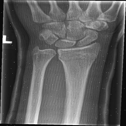 yolo_v11_grazpedwri Object Detection Model (v1, 2025-01-29 1:09pm) by ...