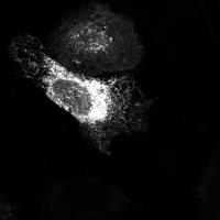 nucleus_segmentation project thumbnail