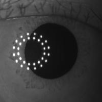 Corneal_curvature project thumbnail
