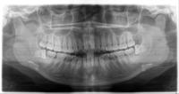 400 Phim Pano (101-130) project thumbnail