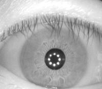 IRIS project thumbnail
