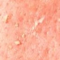 skinzy-dataset project thumbnail