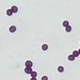 gram detection project thumbnail