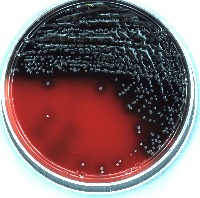 bacteria_detect project thumbnail