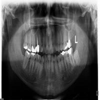 teeth det project thumbnail