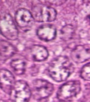 Mitosis counting project thumbnail