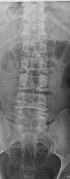 spine seg project thumbnail