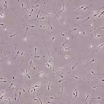 Sperm Detection 10X_Sperm Object Detection Dataset by AiriumAI