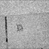 Hail damage project thumbnail