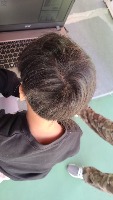 scalp diseases project thumbnail