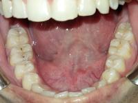Mandibular 2 project thumbnail