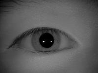 Human iris detecton project thumbnail