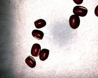 bean detection 2 project thumbnail