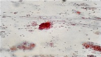 cito-glandular-single-olddataset project thumbnail