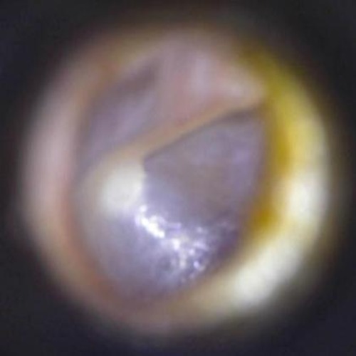 Embedded Object Ear Ear-Disease Object Detection Model by privacydetailsdetection
