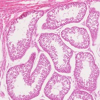 singletubule1024 project thumbnail