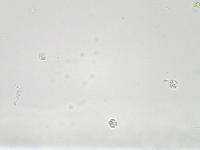 urine-analysis1-q0uii-lwit project thumbnail