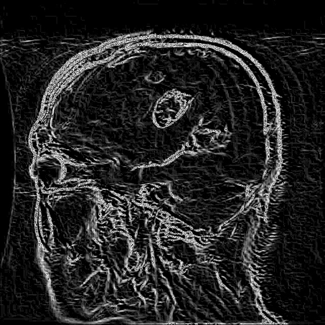 MRI Object Detection Dataset by Brain