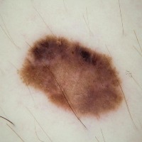 skin project thumbnail