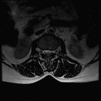 segmentation project thumbnail