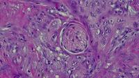 Trial Classification PNI 6 Feb project thumbnail