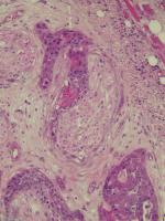 Trial Classification PNI project thumbnail