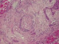 Trial Annotation PNI project thumbnail