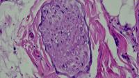 Trial Classification PNI 24 FEB project thumbnail