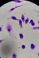 AM_Detection project thumbnail