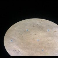 MicroPlastic Object Detection Model by Project