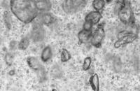 0.5_240_4_1 project thumbnail