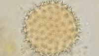 Pollen-Identification project thumbnail