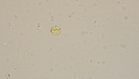 fram-pollen-identiciction project thumbnail