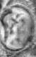 tooth point detection project thumbnail