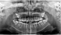 smart teeth project thumbnail